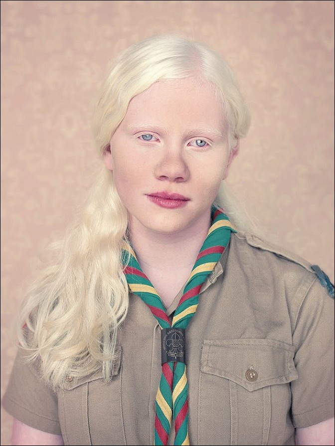 Albinos Project by Gustavo Lacerda