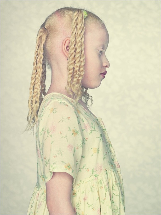 Albinos Project by Gustavo Lacerda