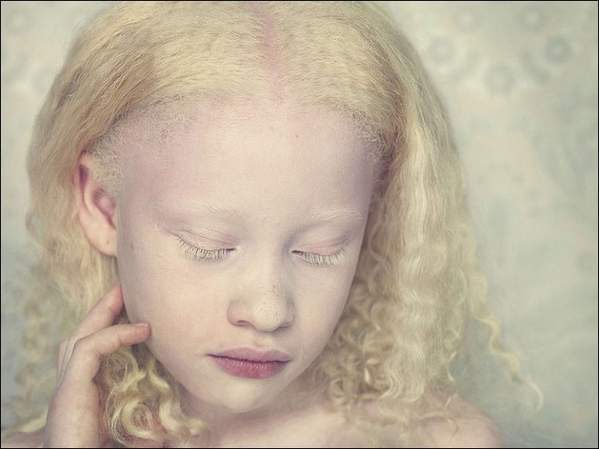 Albinos Project by Gustavo Lacerda