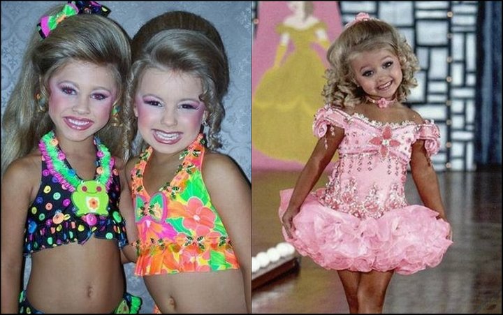 child-beauty-pageant-fake-teeth