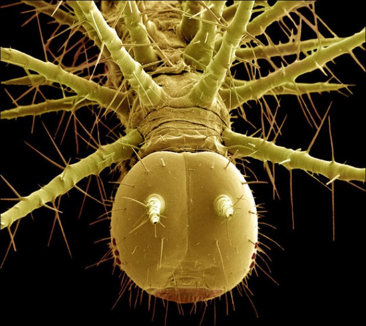 Steve Gschmeissner’s Incredible Microscope Photos of Insects