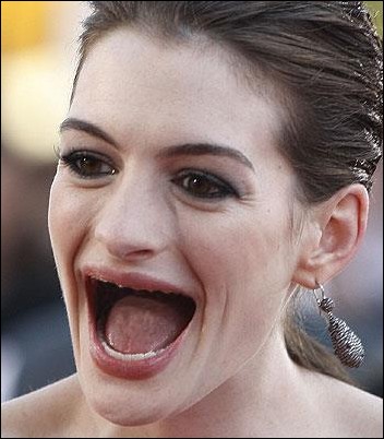 ACTRESSES WITHOUT TEETH