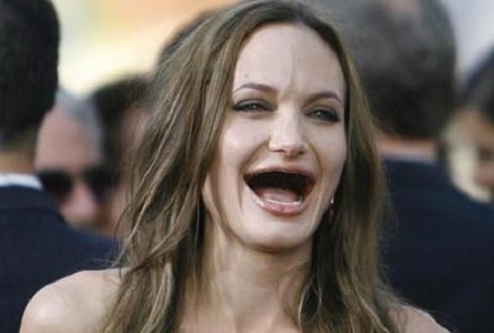 ACTRESSES WITHOUT TEETH